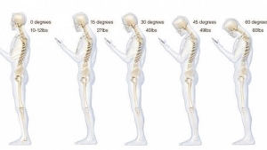 Как постоянное использование мобильных гаджетов влияет на состояние шейного отдела позвоночника?